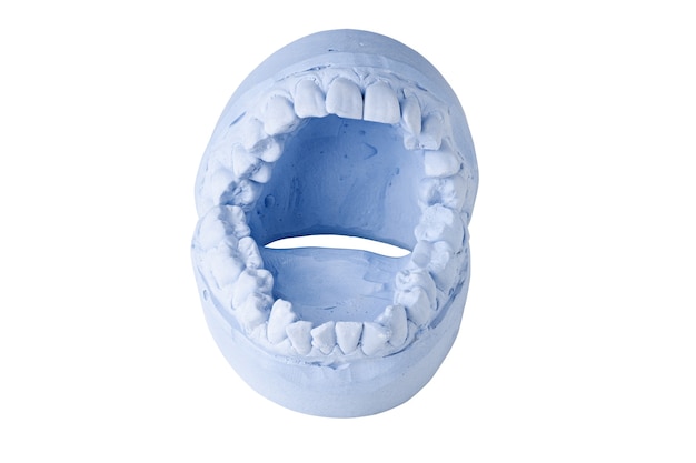 Wycisk dentystyczny na białym tle