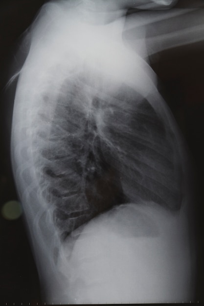 X ray skanowania z tyłu