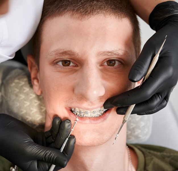 Zbliżenie na twarz mężczyzny i dłonie dentysty zakładające gumki na wsporniki
