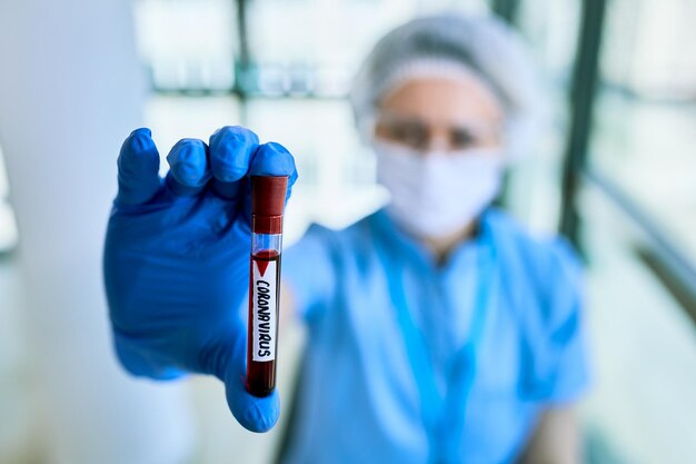 Zbliżenie pielęgniarki trzymającej próbkę krwi COVID19 w uchwycie na próbki