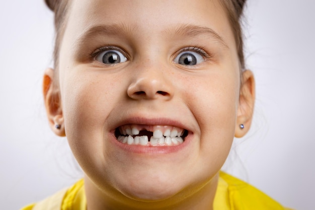 Zbliżenie super podekscytowana kobieta z otwartymi ustami pokazująca brakujący przedni ząb dziecka i wybrzuszenie...