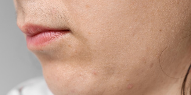 Zbliżenie twarzy kobiety z wąsami nad ustami i czarnymi włoskami na skórze
