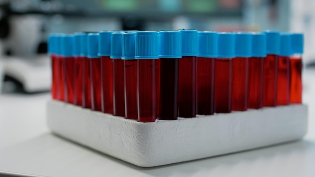 Cerca de muestras de sangre en vacutainer en bandeja médica en laboratorio de ciencias. Tubos transparentes con líquido de adn rojo para pruebas genéticas. Frascos de vidrio de solución biológica coloreada