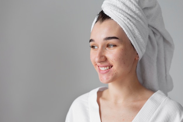 Cerrar mujer sonriente con acné posando