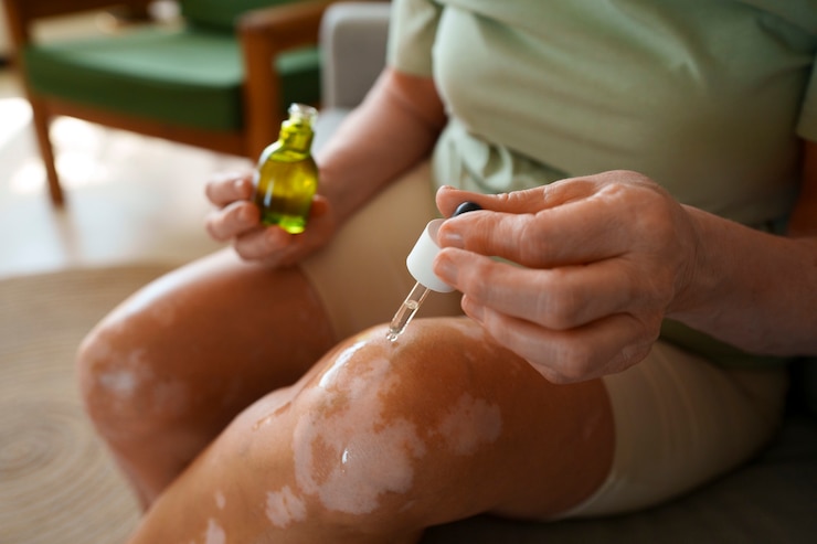 Foto gratuito cerrar mujer usando aceite de cbd