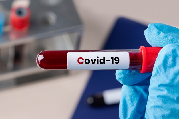 Cirujano sosteniendo un tubo de ensayo de sangre de coronavirus