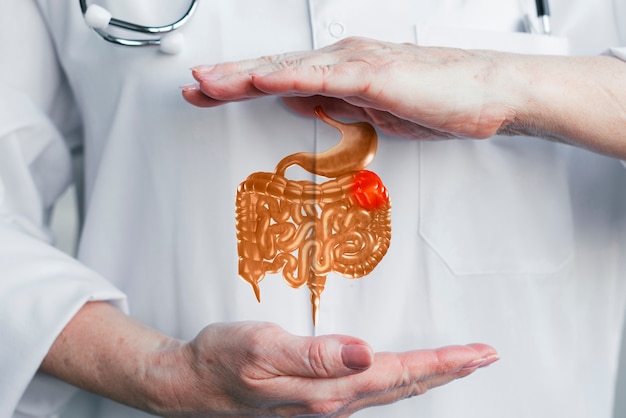 Cáncer de colon. Foto Freepik