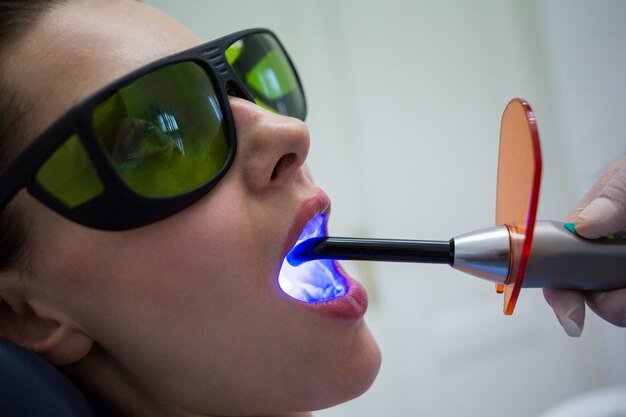 Dentista examina los dientes de los pacientes con luz de curado dental