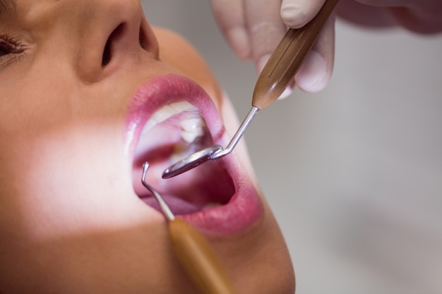 Dentista examinando los dientes del paciente femenino