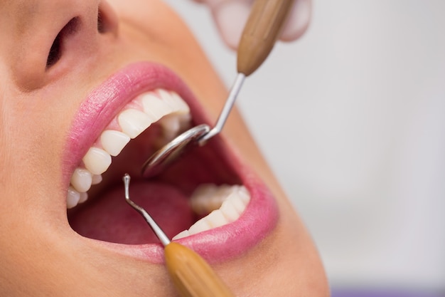 Dentista examinando los dientes del paciente femenino