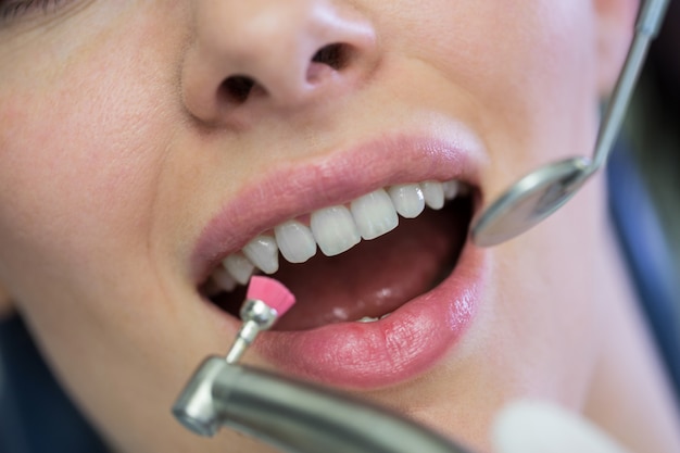 Dentista examinando a una paciente con herramientas