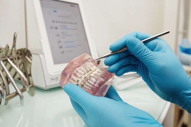 Foto gratuita dentista con modelo de plástico dental con tirantes
