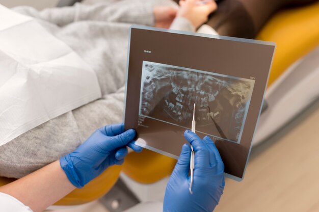 Dentista mostrando al paciente sus radiografías