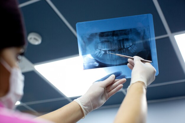 El dentista revisa la foto de rayos X de la boca