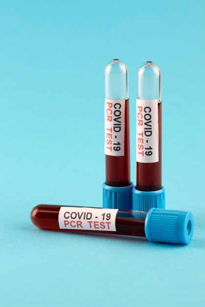 Disposición de las pruebas de covid-19 pcr