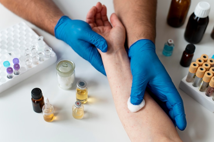 Foto gratuito doctor comprobando la alergia cutánea de una persona