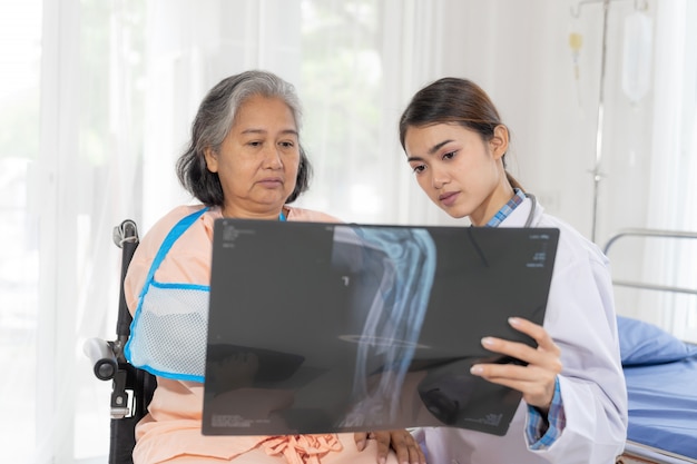 Doctor Informar los resultados del examen de salud de la película de rayos X para alentar a la mujer mayor de edad avanzada Pacientes con brazo roto en el concepto médico-hospitalario