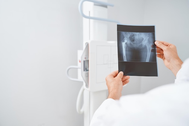 Doctor sosteniendo con las manos escaneadas después del diagnóstico por ultrasonido