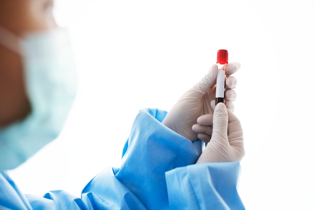 Doctor sosteniendo un tubo de ensayo de sangre