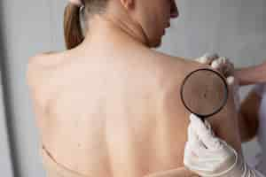 Foto gratuita doctora diagnosticando un melanoma en el cuerpo de una paciente