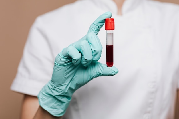 Enfermera sosteniendo un tubo de ensayo de sangre