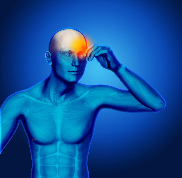 Figura médica azul 3D sosteniendo la cabeza en el dolor