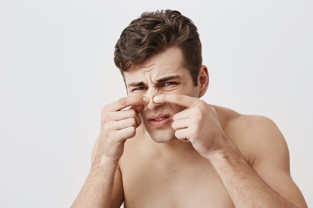 Hombre musculoso desnudo con una apariencia atractiva, frunciendo el ceño, tocarse la nariz y tener problemas de piel Hombre caucásico con cabello oscuro, mirando con sus ojos azules. Concepto de belleza y juventud.