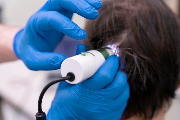 Hombre recibiendo un tratamiento para la caída del cabello