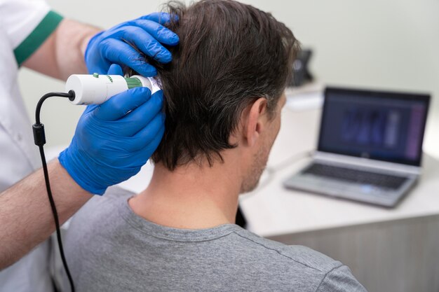 Hombre recibiendo un tratamiento para la caída del cabello