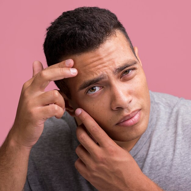 Hombre tratando de deshacerse de las imperfecciones de la piel de su rostro