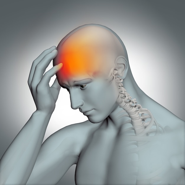 Ilustración de figura humana con dolor de cabeza