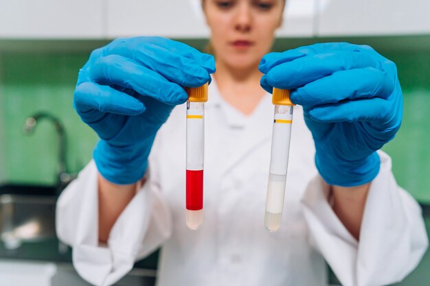 Investigador médico o científico femenino tiene en las manos un tubo de ensayo.