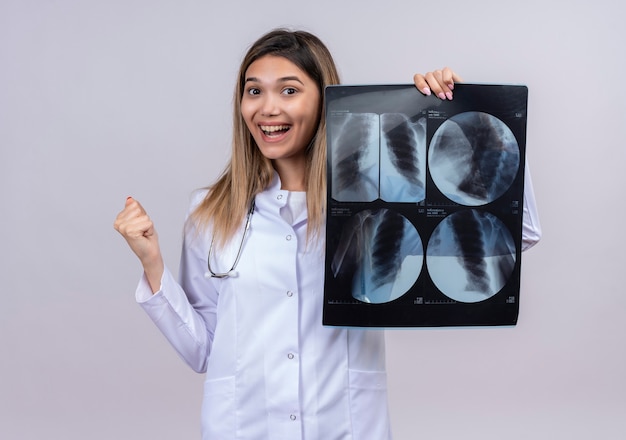 Joven y bella mujer médico vistiendo bata blanca con estetoscopio sosteniendo el puño de rayos x feliz y salido concepto ganador