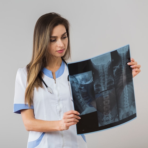 Joven médico mirando una radiografía