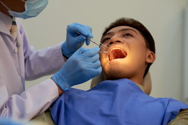 Joven sentado boca abierta en el consultorio del dentista en el examen anual