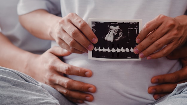 Jóvenes asiáticos embarazadas pareja muestran y mirando la foto de ultrasonido bebé en el vientre. Mamá y papá se sienten felices sonriendo pacíficos mientras cuidan al niño acostado en el sofá en la sala de estar en casa.