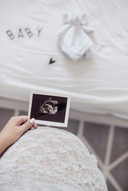 Madre sosteniendo una foto de rayos x del feto cerca de su vientre
