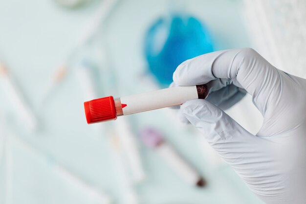 Mano del médico sosteniendo un tubo de análisis de sangre durante el brote de covid-19