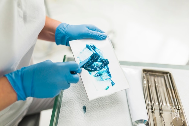 Foto gratuita las manos del dentista mezclando impresión de silicona azul
