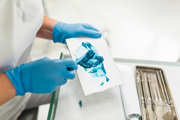 Las manos del dentista mezclando impresión de silicona azul