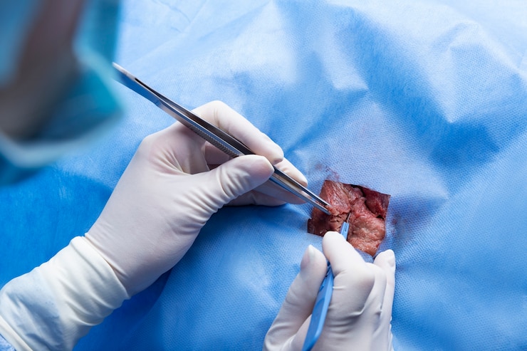 Foto gratuito medic operando con bisturí metálico