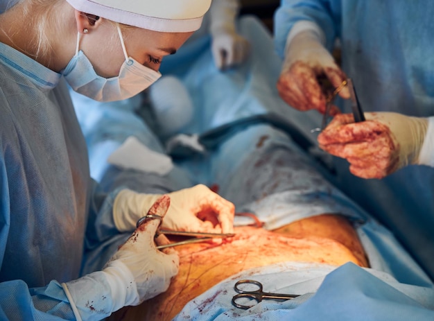 Médico y asistente cosiendo la herida después de la cirugía de abdominoplastia