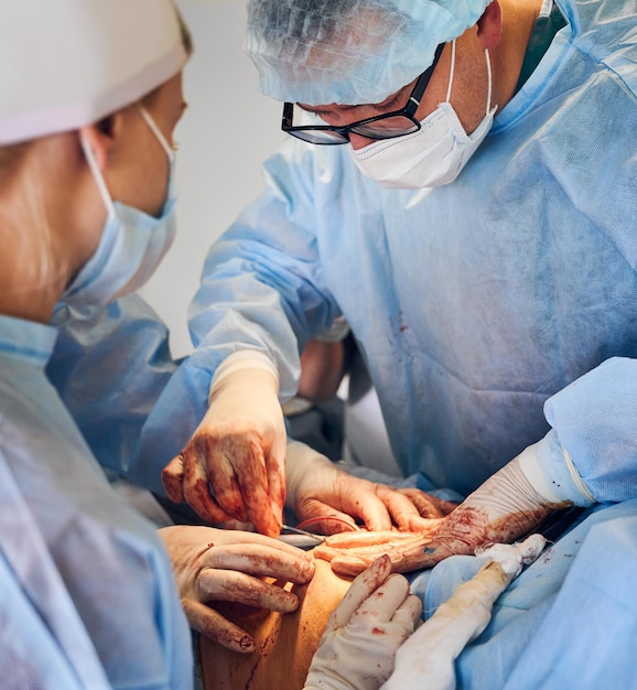 Médico y asistente haciendo cirugía de abdominoplastia en quirófano