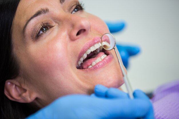 Médico examina los dientes de pacientes femeninos con el espejo de boca