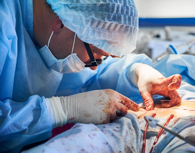 Médico masculino colocando suturas después de un procedimiento de abdominoplastia