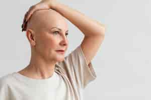 Foto gratuita mujer con cáncer de piel con espacio de copia