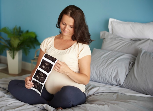 Mujer embarazada navegando por la imagen de ultrasonido de su bebé