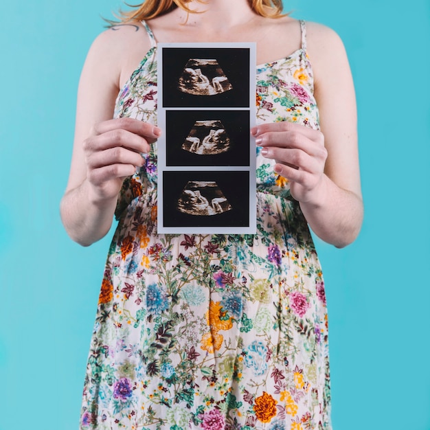 Foto gratuita mujer embarazada sujetando ultrasonido