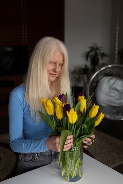 Mujer joven con albinismo y flores de tulipán.