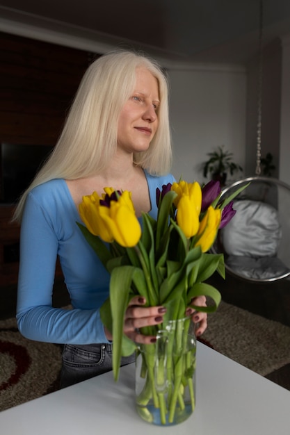 Mujer joven con albinismo y flores de tulipán.